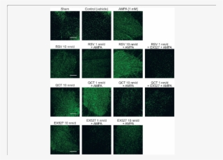 Effect Of Rsv, Qct And Ex527 On Spinal Astroglial Cell