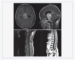Human Spine White Png Exray