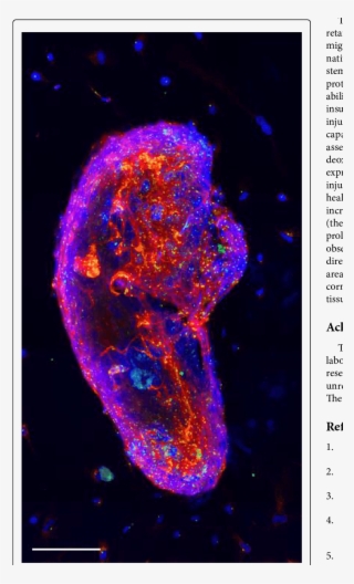 A Sphere Of Corneal Stem Cells Stained For Dapi Tubulin