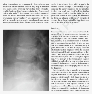 A Lateral Radiograph Of The Lumbar Spine In A 28 Year