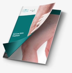 Download Your Free Guide To Varicose Veins - Varicose Veins