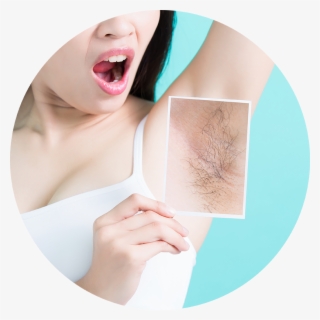 Laser Hair Removal Treatment
