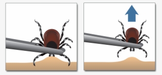 You Found A Tick Now How Do You Get Rid Of It Learn