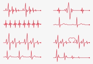 Heart Rate Electrocardiography Clip Art - Batimentos Cardiacos Vetor Png