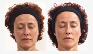 Complete Anti Ageing