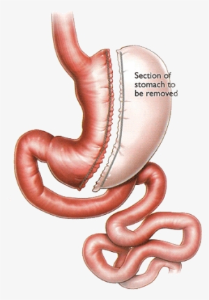 Our Services - Earthworm