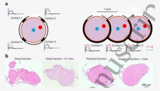 A) Schematic Representation Of The Sciatic Nerve With