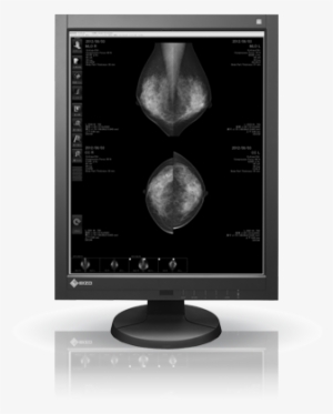Changing The Mammographic Imaging Paradigm - Eizo Radiforce G5310