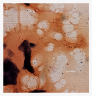 A Small Fragment Of A Mouse Pellet From An Antibiotic