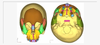 Geometric Model Of The Skull
