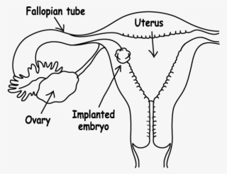 Embryo Implantation