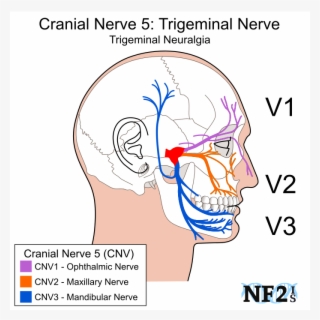 Cranial Nerve 5, Subparts, 3 Branches, Branches, Filiment,