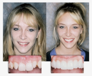 Dramatic Before And After Transformation At Integrative