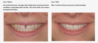 Case 1 - After