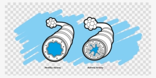Asthma Png Clipart Asthma Spacer Respiratory Tract