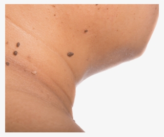 Mole
