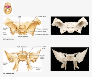 The Skull