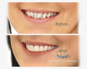 Slide-six Month Smile - Lip Gloss