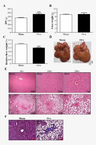 Effect Of Ovx On Liver Gross And Histopathology - Colorfulness