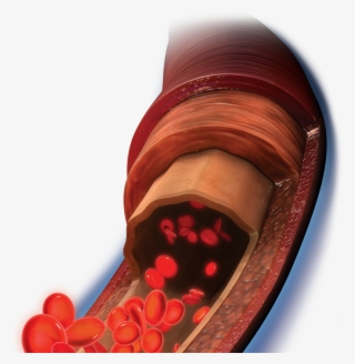 Tissue And Circulation - Medical Equipment