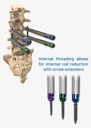 System Features - Tool