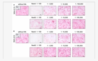 Influence Of Recombinant Nana And Nanb On Expression - Style