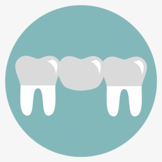 A Bridge Is One Method To Replace Missing Teeth, And - Bridge Tooth Icon