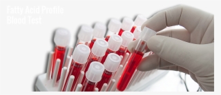 Keep Fat Related Health Problems In Check - Blood Test Tubes Png