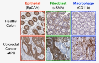 Figure 1 - Igneous Rock