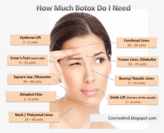 These Infographics Refer To The Proprietary Botox Product - Can You Use Botox