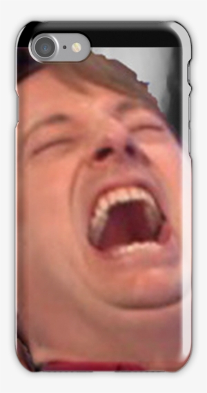 'david Mitchell Hysterical Laugh' Iphone Case By James - Iphone
