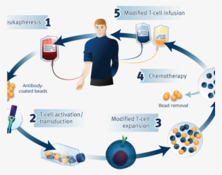 Car T Process - Car T Cell Therapy Process