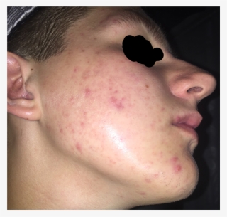 Pic 1 - No Expression