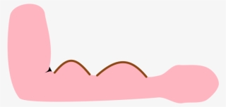 Dialyse Shunt Arm