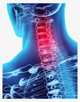 Auto Accident Chiropractor - Chiropractor