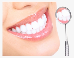 Should I Be Whitening My Teeth - White Teeth Dental Services