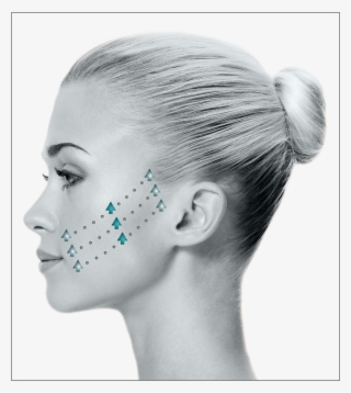 To Learn More About The Benefits Of Instalift, Schedule - Get The Perfect Nose