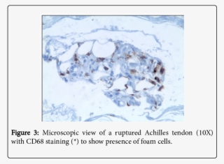 Shows The Results Of The Laboratory Tests - Snow