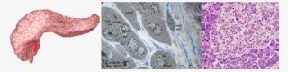 Diagram Of Pancreas And Two Photos Of Specific Pancreatic - Atlas