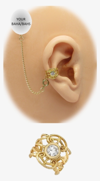 Image - Gold