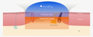 Finally, Thermal Energy Is Delivered And The Sweat - Graphic Design