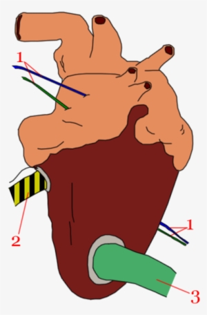 394px-coeur Auxiliaire - Secondary Heart Space Marine