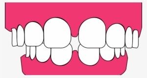 Clip Art Black And White Jasper Ave Dental Tips To - Teeth Graphic