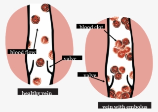 Dvt Web Full - Circle