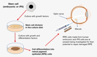 Diagram On Developing Eye Therapies - Stem Cell Eye Therapy