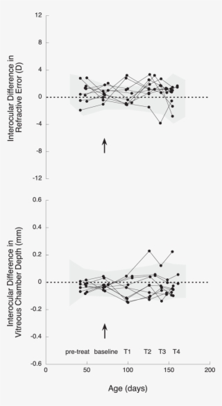 Interocular Differences At Pretreatment - Diagram