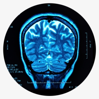 Traumatic Brain Injury