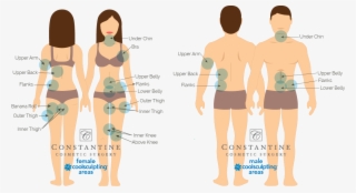 No Matter Which Area You May Be Considering For Coolsculpting, - Cartoon