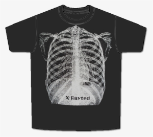 X Ray Short