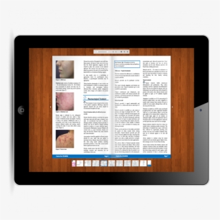 Acne Treatment Acne Treatment - Tablet Computer